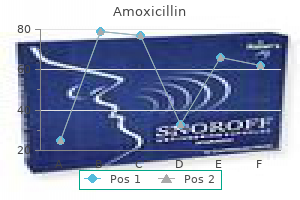 cheap 250mg amoxicillin with amex