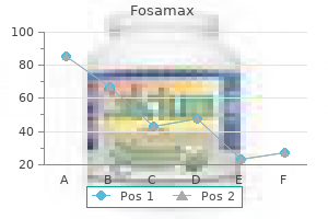 buy fosamax 70 mg fast delivery