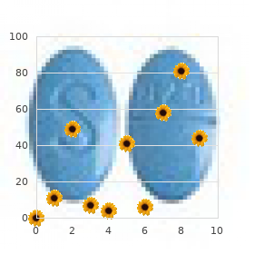 Microcephaly cardiac defect lung malsegmentation