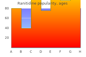 buy ranitidine 300 mg line