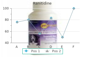 order ranitidine 150 mg with visa