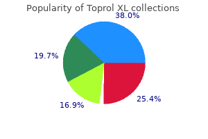 buy toprol xl 100mg with mastercard